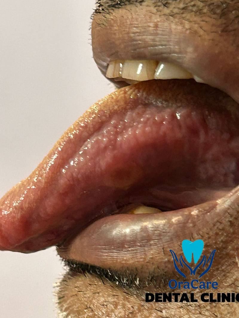 Dentist examining a patient before root canal treatment